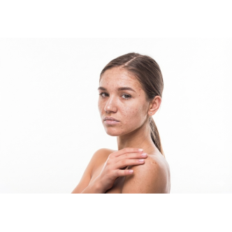 Champú Aclarante De Pelo | Brillo y Reflejos Rubios